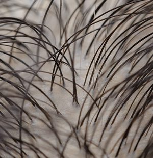 ile kosztuje trichoskopia we Wrocławiu