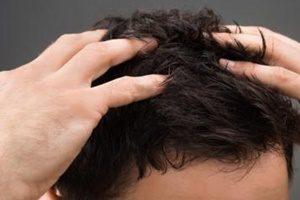 metody leczenia łysienia Wrocław