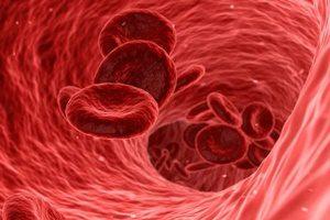 Przeszczep włosów Wrocław