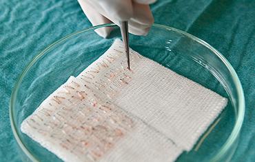 Przeszczep włosów w Turcji